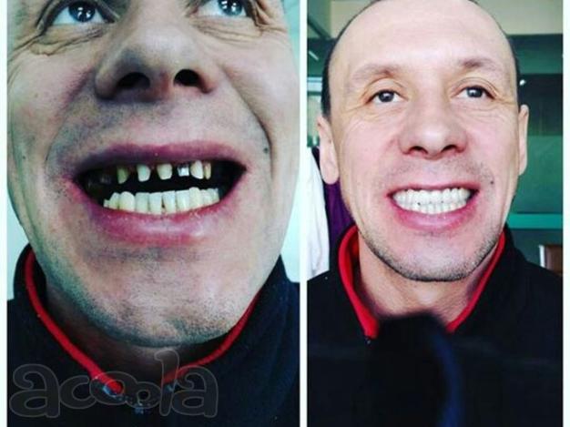 Стоматологические услуги в Хэйхэ